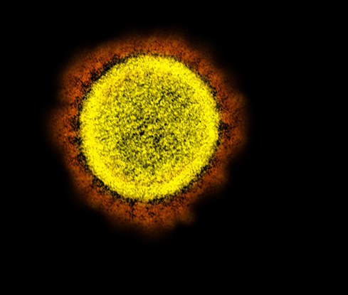 A yellow spike protein is found on the surface of the virus and forms an orange “crown” or “halo” around the virus.
