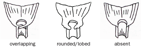 Three black and white drawn diagrams of auricles sit next to each other. The left is an overlapping auricle, the middle is a rounded/lobed auricle, and the right is an absent auricle.