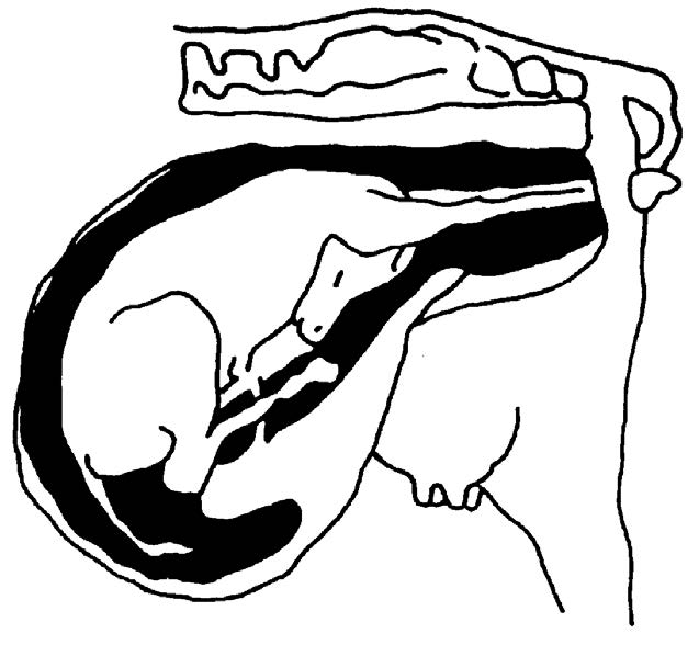 a sketch of a calf inside a uterus with its legs forward and its head bent down.