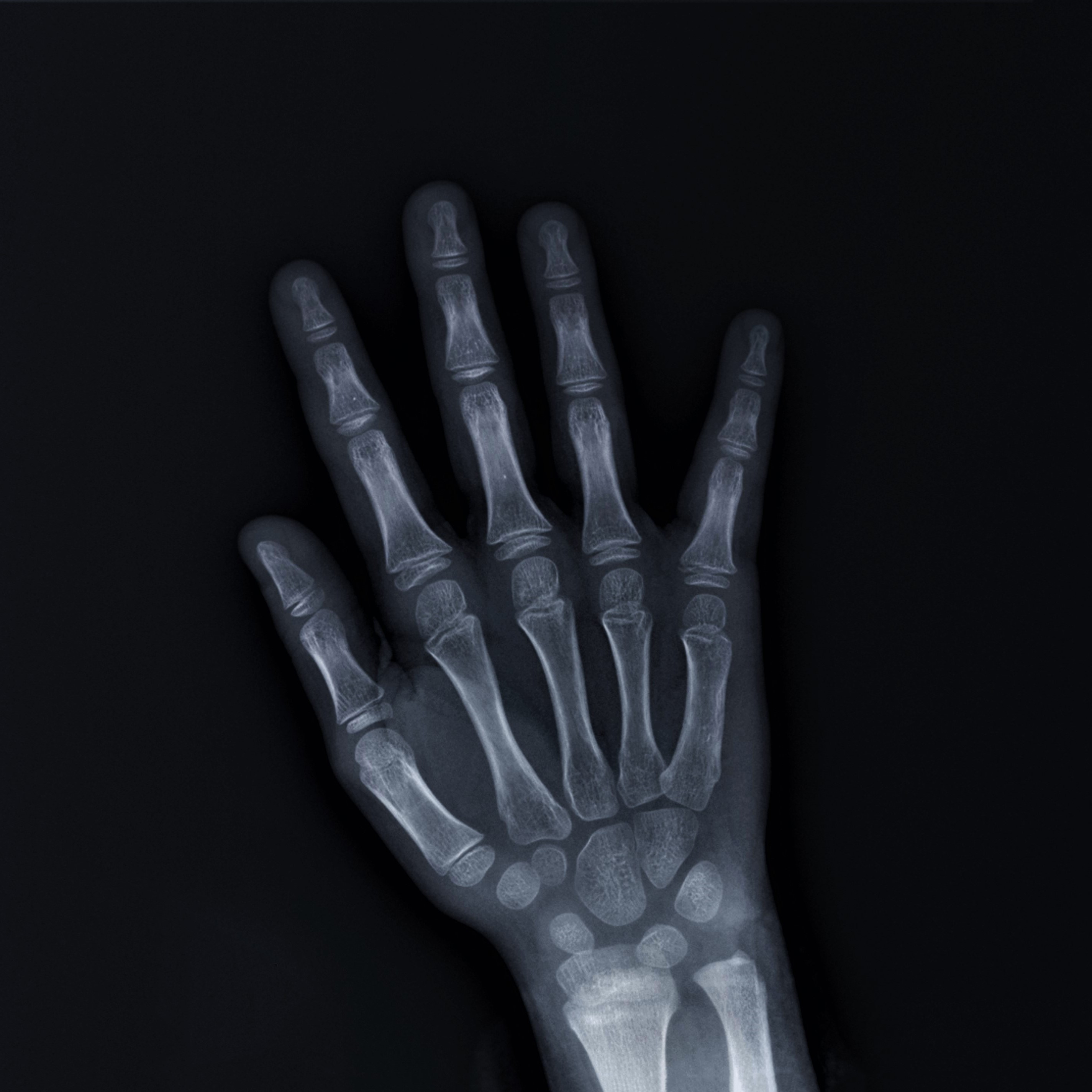 x-ray of hand